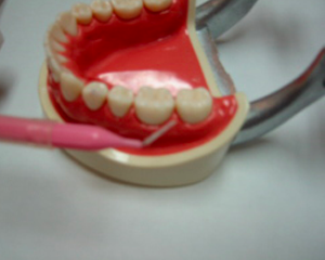 歯と歯の間は歯間ブラシで