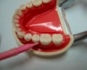 挿入。歯と歯の間の歯肉もケアしましょう。要するに磨きにくい所を重点的に磨きましょう。